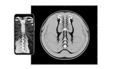 What Does a CT Scan Show