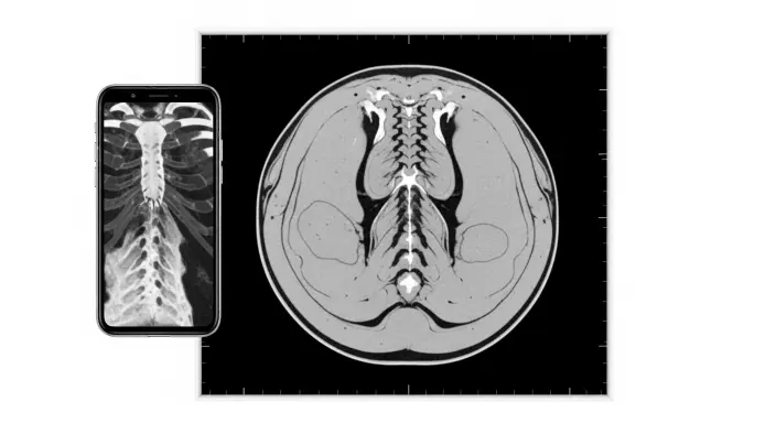 What Does a CT Scan Show